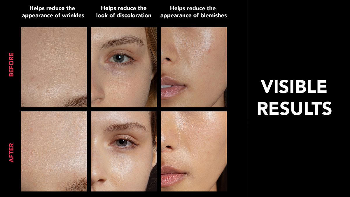 Before and after LED light therapy closeups of face - forehead, cheeks, and eyes with reduced wrinkles, less discoloration, and reduced blemishes